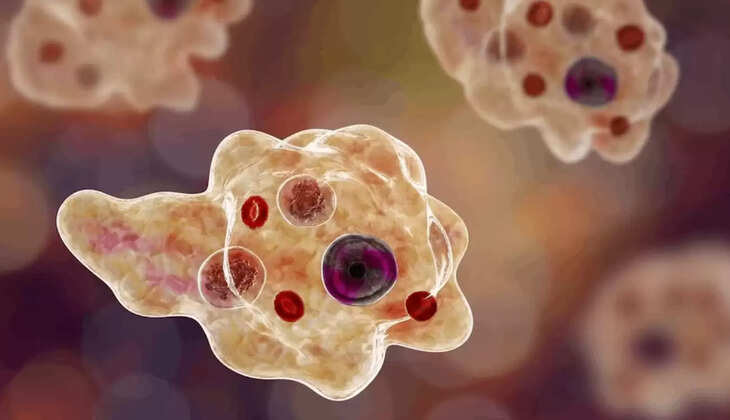 Amoebic Encephalitis